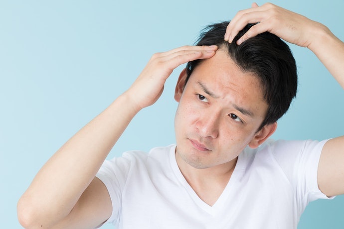 Sử Dụng Thuốc Mọc Tóc Đúng Cách