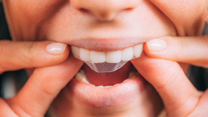 Những Lưu Ý Khi Sử Dụng Miếng Dán Trắng Răng