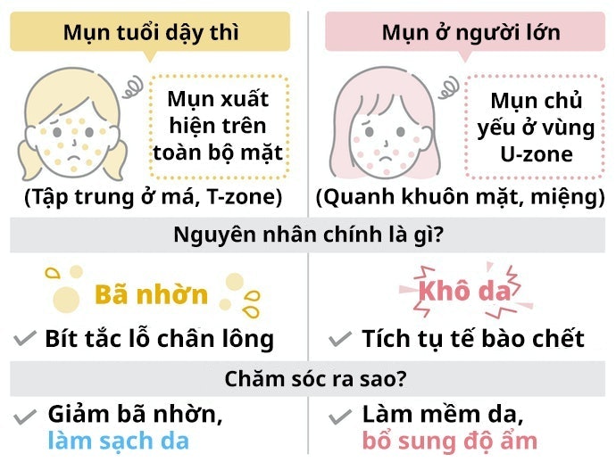 Nên Chọn Riêng Sữa Rửa Mặt Cho Tuổi Dậy Thì