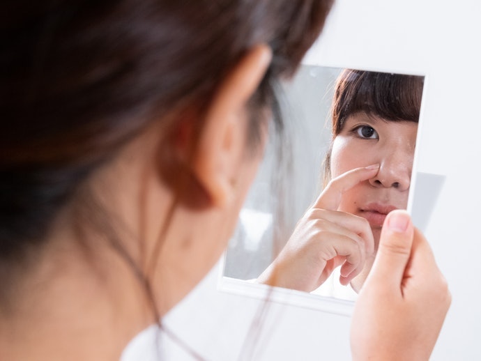 Nguyên Nhân Gây Mụn Đầu Đen Là Gì?