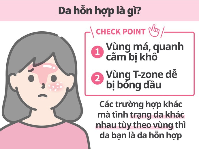 Da Hỗn Hợp: Nguyên Nhân Và Cách Xác Định