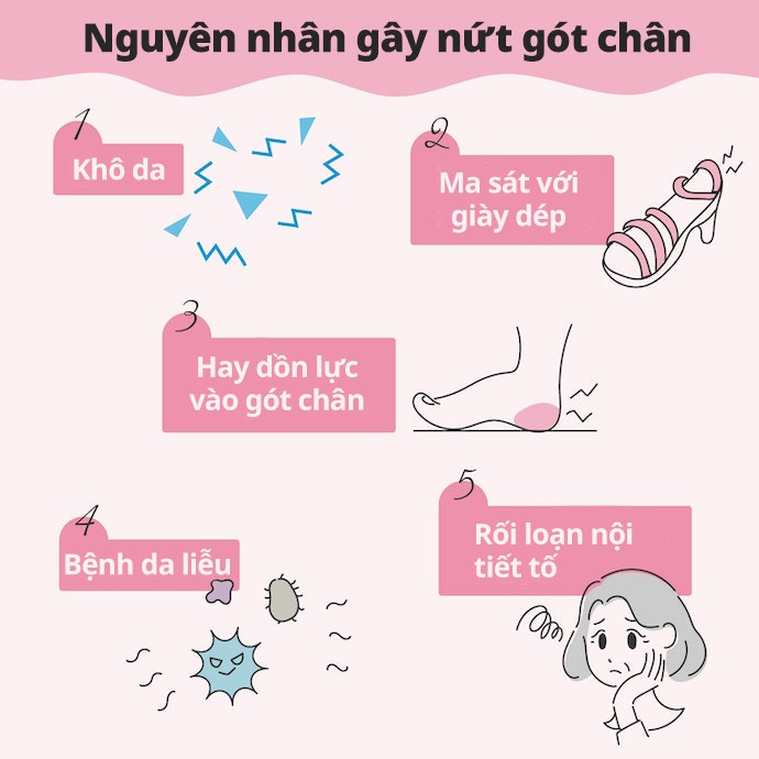 Nguyên Nhân Gây Nứt Gót Chân Là Gì?