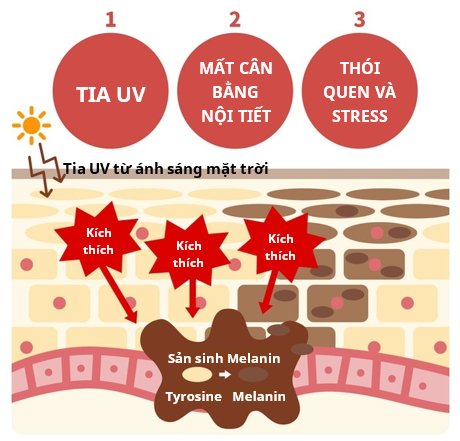 Nguyên Nhân Gia Tăng Sắc Tố Da? Viên Uống Trắng Da Có Thật Sự Làm Trắng Da?