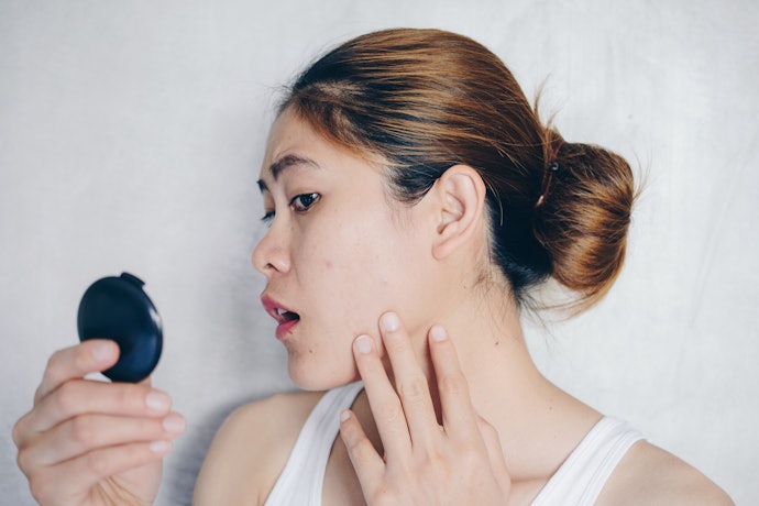 Cách Hạn Chế Và Trị Thâm Mụn
