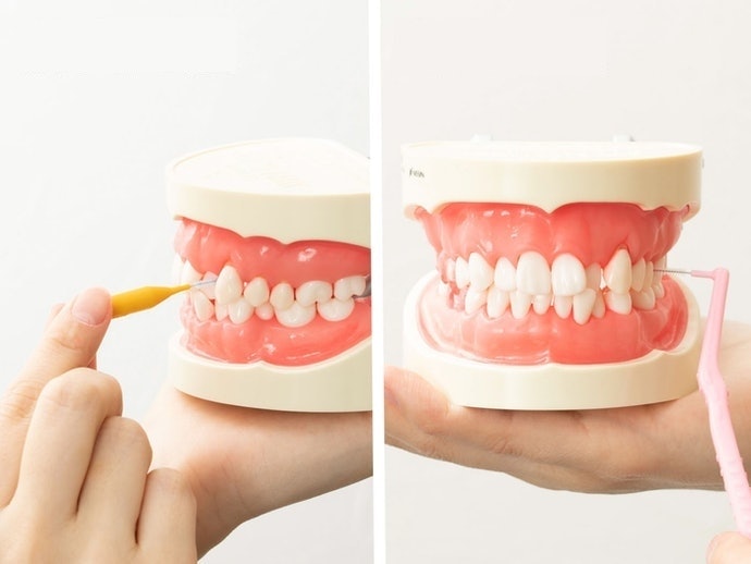Răng Cửa: Bàn Chải Chữ I, Răng Hàm: Bàn Chải Chữ L