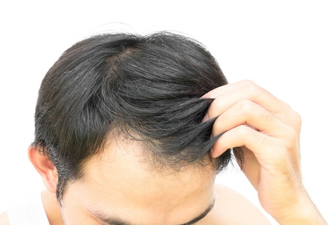 Axit Amin Không Hiệu Quả? Dùng Dầu Gội Dược Mỹ Phẩm