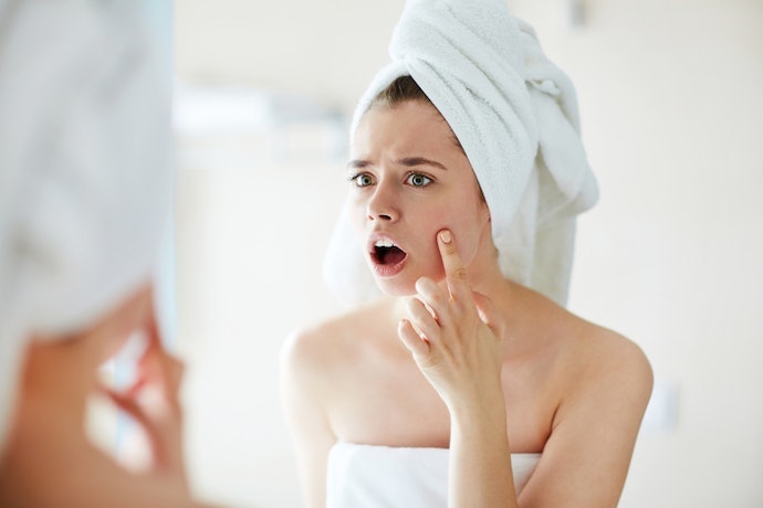 Thâm Mụn: Cân Nhắc Các Thành Phần Trị Thâm, Giúp Làm Sáng Da