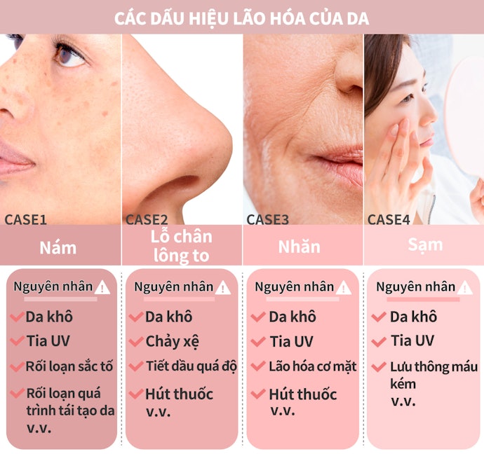 Kiểm Tra Các Dấu Hiệu Của Sự Lão Hoá