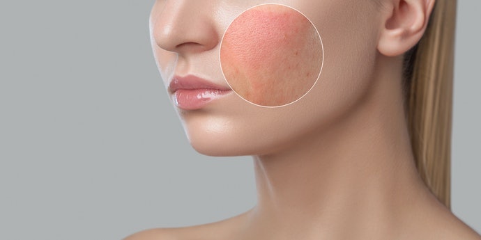 Tránh Thành Phần Dễ Gây Kích Ứng Như Hương Liệu, Paraben, v.v.