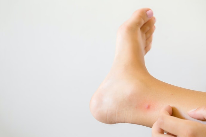 Miếng Dán Chống Trầy Xước Tiện Lợi Dùng Cho Trẻ Em