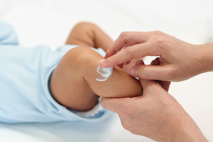 Nếu Tình Trạng Da Bé Không Cải Thiện, Hãy Chọn Kem Chứa Petrolatum (Vaseline), Kết Cấu Dạng Mỡ Giúp Giữ Ẩm Tốt Hơn