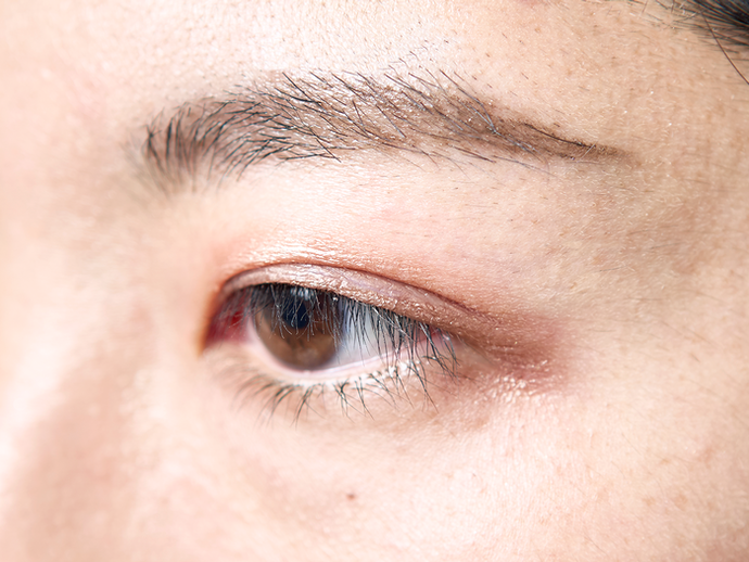 Kiểm Tra Xem Có Thể Makeup Mắt Đẹp Với Keo Kích Mí Đó Không