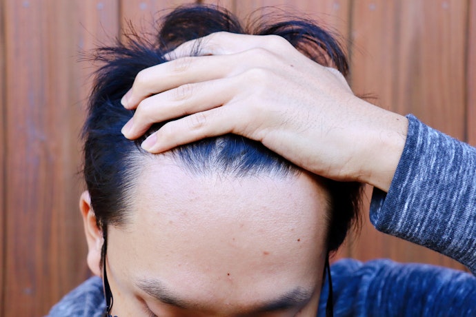 Sự Khác Biệt Về Tỷ Lệ Thành Phần Giữa Thuốc Mọc Tóc Cho Nam Và Nữ