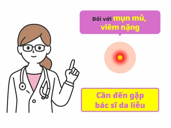 Mụn Mủ: Chọn Kem Chứa Hoạt Chất Kháng Viêm, Kháng Sinh