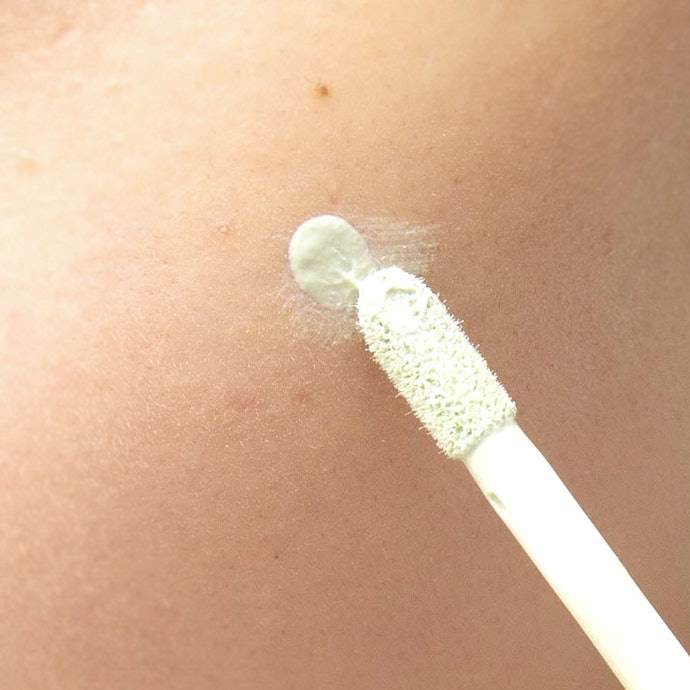 Mụn: Tránh Gây Kích Thích Vùng Da Mụn, Dùng Theo Tình Trạng Mụn