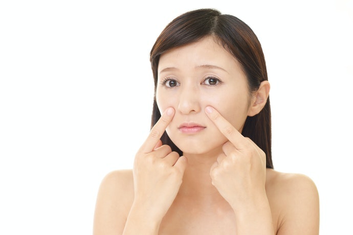 Thành Phần Giúp Chăm Sóc Da Mụn, Cải Thiện Lỗ Chân Lông