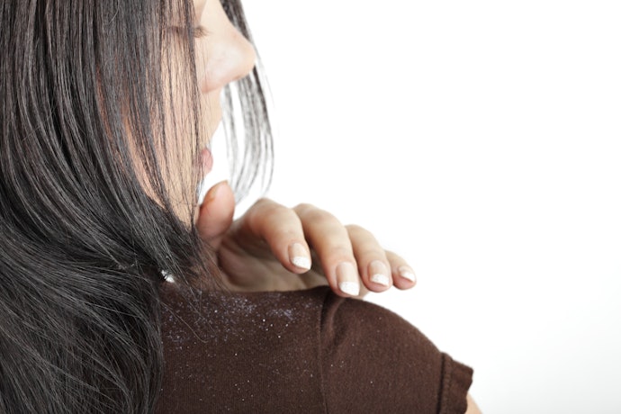Dầu Gội Dược Liệu: Dành Cho Những Bạn Lo Sợ Vấn Đề Về Da Đầu