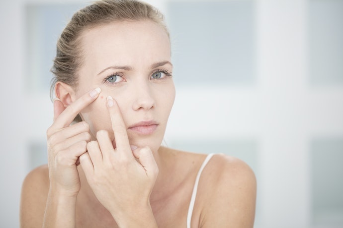 Dipotassium Glycyrrhizinate, Axit Salicylic: Chăm Sóc Mụn