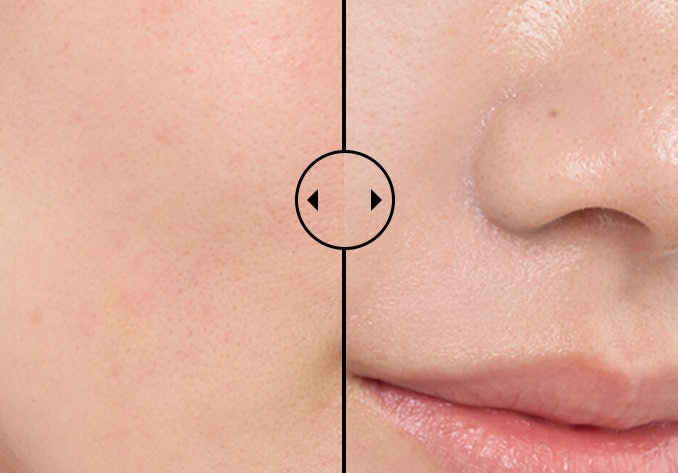 Muốn Che Phủ Lỗ Chân Lông Hoặc Nếp Nhăn, Chọn Kem Lót Gắn Nhãn Pore-Minimizing, Chứa Dimethicone Hoặc Cyclopentasiloxane
