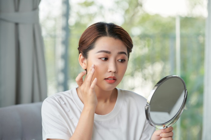 Kem Ốc Sên Trị Mụn Với Các Thành Phần Làm Dịu, Kháng Viêm