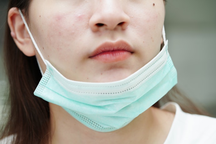 Da Nhạy Cảm Dầu Mụn: Chọn Thành Phần Kháng Viêm Có Nồng Độ Phù Hợp