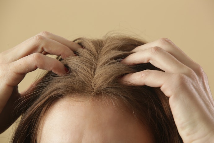 Nếu Bị Ngứa, Gàu: Hãy Chú Ý Thành Phần Trị Ngứa Và Kháng Viêm