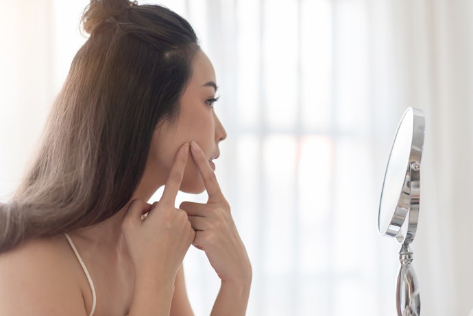 Kháng Khuẩn, Kháng Viêm Phục Hồi Làn Da Mụn, Sau Nặn Mụn