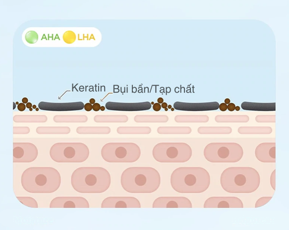 Da Dầu, Mụn: Chọn Thành Phần Làm Sạch Da Chết, Kháng Viêm