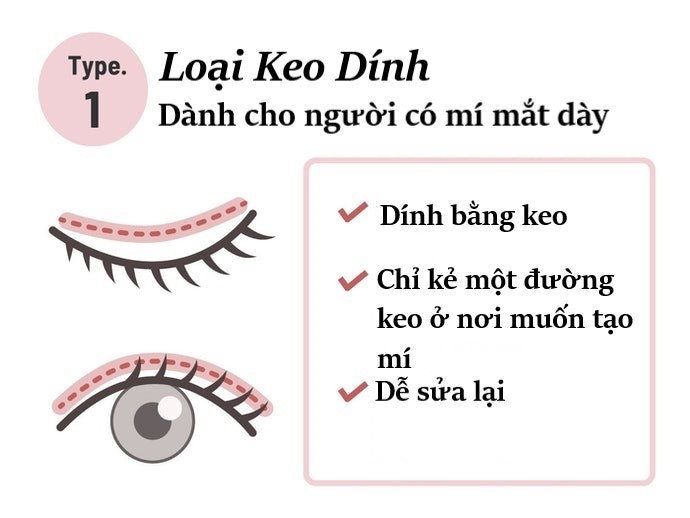 Loại Keo Dính: Dàng Cho Mắt Khó Tạo Nếp Hai Mí, Mí Mắt Dày