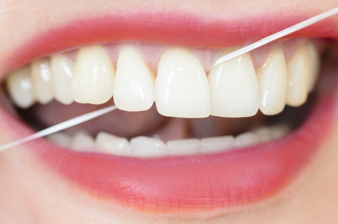 Chỉ Nha Khoa Nylon Dễ Cạo Sạch Chất Bẩn
