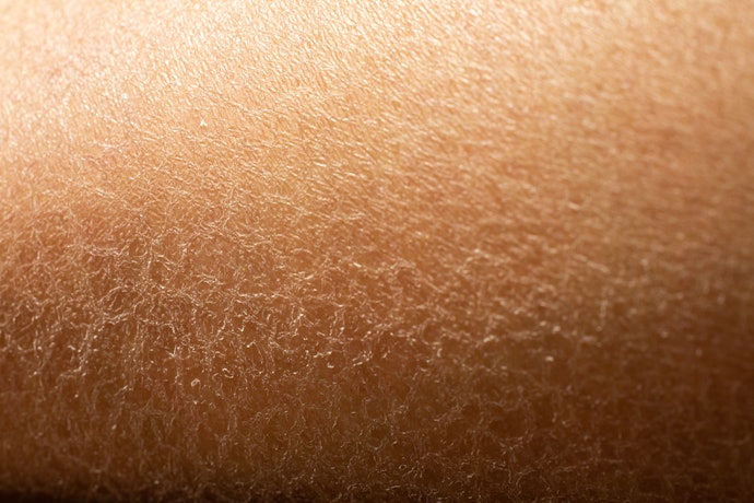 Da Khô, Bong Tróc: Chọn Thành Phần Dưỡng Ẩm, Cấp Nước Như Hyaluronic Acid