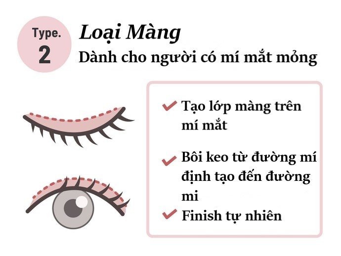Loại Màng: Dành Cho Mắt Dễ Tạo Nếp Hai Mí, Mí Mắt Mỏng