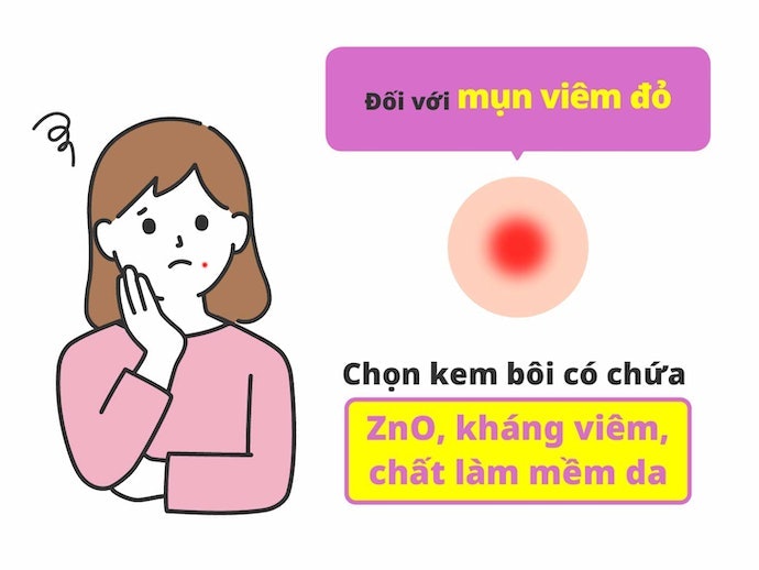 Mụn Viêm Đỏ, Trứng Cá: Chọn Kem Trị Mụn Kháng Viêm
