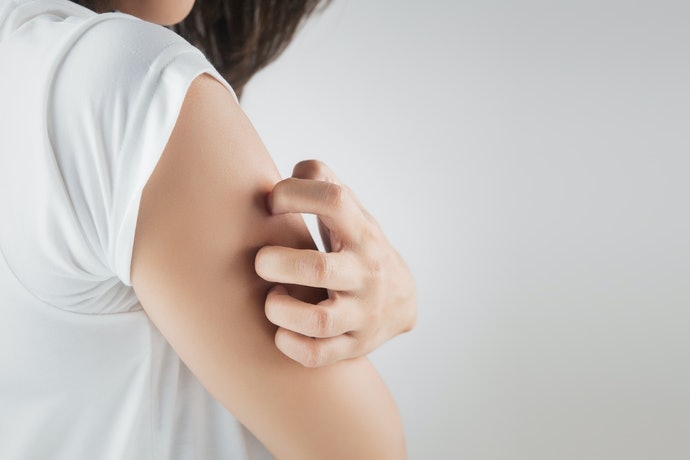 Nếu Chỉ Ngứa Thì Chọn Loại Có Chứa “Kháng Histamin”