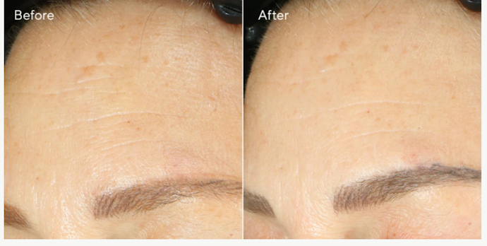 Da Lão Hóa Chọn Retinol Có Bổ Sung Acid Hyaluronic, Peptide, Vitamin C, và Niacinamide Giúp Tăng Hiệu Quả