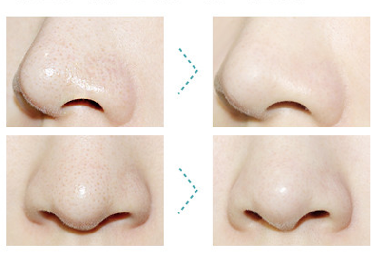Holika Holika Pig Clear Blackhead 3-Step Kit 2