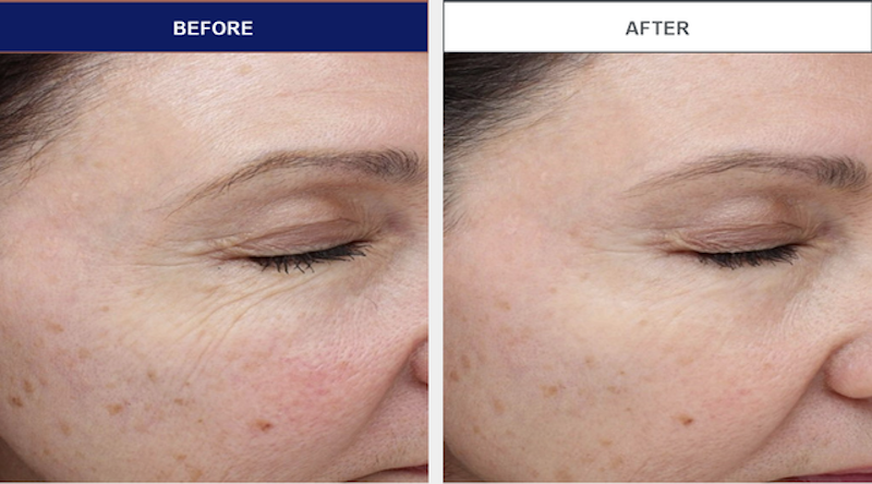 Néotrata Potent Retinol Complex 3