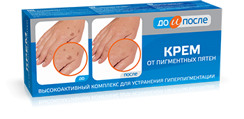 Kem Dưỡng Da Tay nào tốt nhất hiện nay? Cách chọn Kem Dưỡng Da Tay [BS Da Liễu Tư Vấn] 3