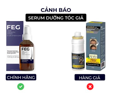 Top 9 Xịt Mọc Tóc tốt nhất hiện nay (Minoxidil, Hairburst, Molty) 4