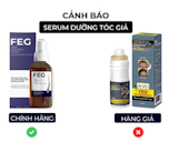 Top 9 Xịt Mọc Tóc tốt nhất hiện nay (Minoxidil, Hairburst, Molty) 4