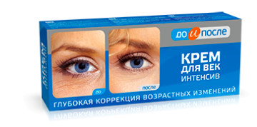 [2024] Top 10 Kem Trị Bọng Mắt tốt nhất hiện nay (Vichy, Estee Lauder, Laneige) 3