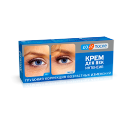 Kem Trị Bọng Mắt Before and After Intensive Eye Cream