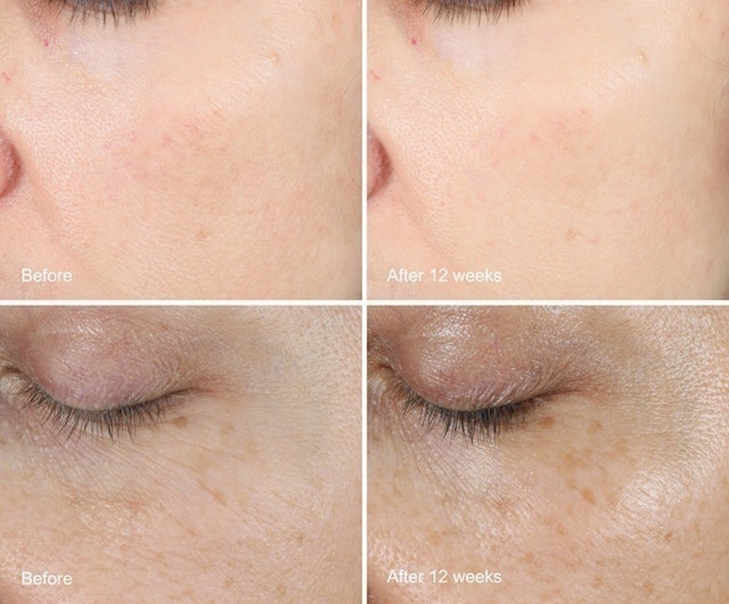 Neutrogena Hydro Boost Gel-Cream for Extra-Dry Skin 3