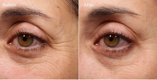 Murad Retinol Youth Renewal Eye Serum 2