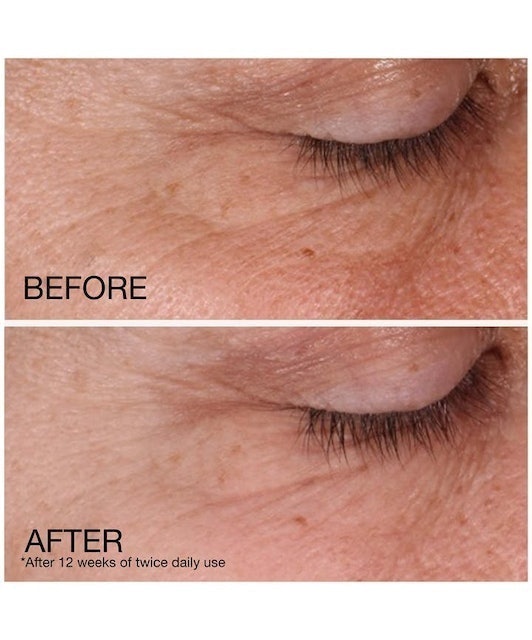 Neutrogena Rapid Wrinkle Repair Regenerating Anti-Wrinkle Retinol Cream 2
