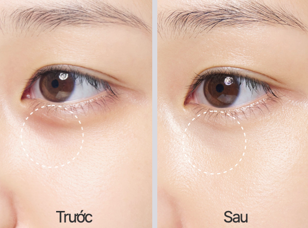 Kem Dưỡng Ẩm Vùng Mắt LANEIGE Water Bank Blue HA Eye Cream 3