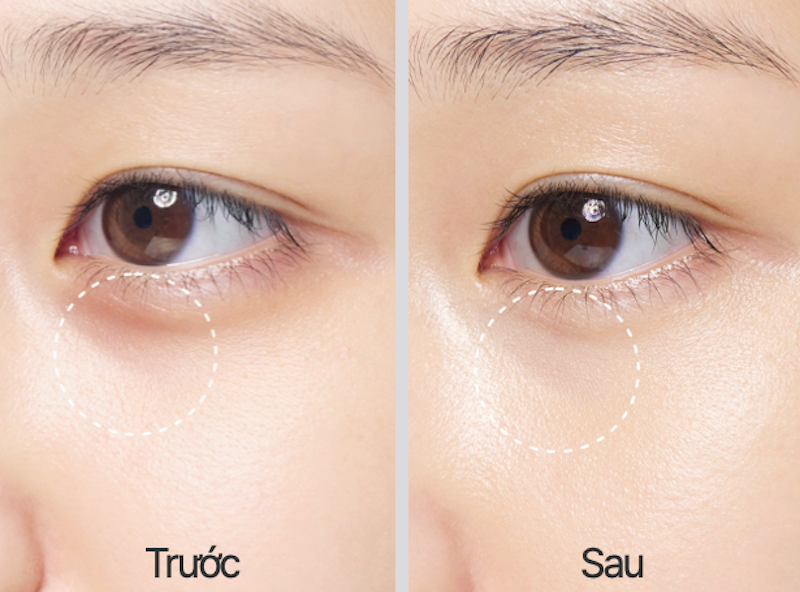 Kem Dưỡng Ẩm Vùng Mắt LANEIGE Water Bank Blue HA Eye Cream 3