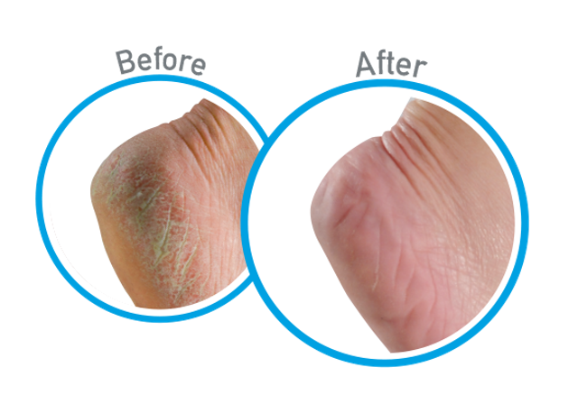 Kem Dưỡng Da Chân Healthy Feet Foot Cream 2