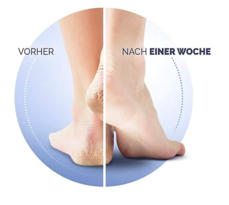 Kem Trị Nứt Gót Chân Scholl Schrundensalbe Salbe Active Repair K+ 2