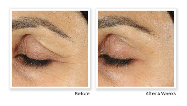 Kem Mắt RETINOL CORREXION Line Smoothing Eye Cream 6
